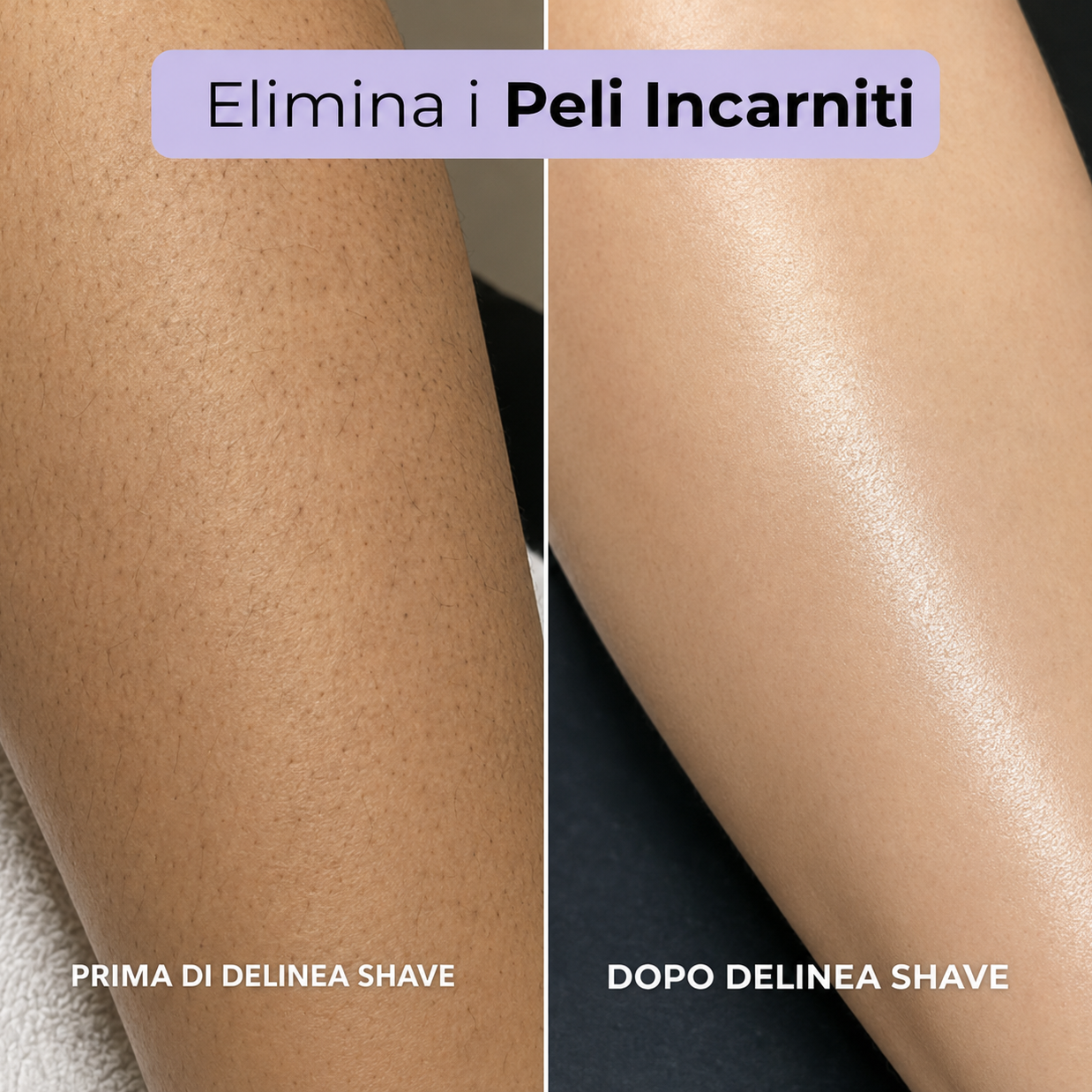 Delinea Shave™ - Rasoio 2 in 1 per bikini e corpo