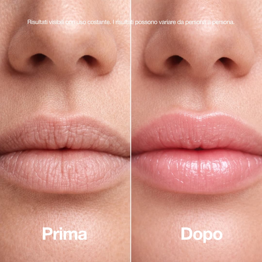 Stick rimpolpante al bio-collagene e PDRN